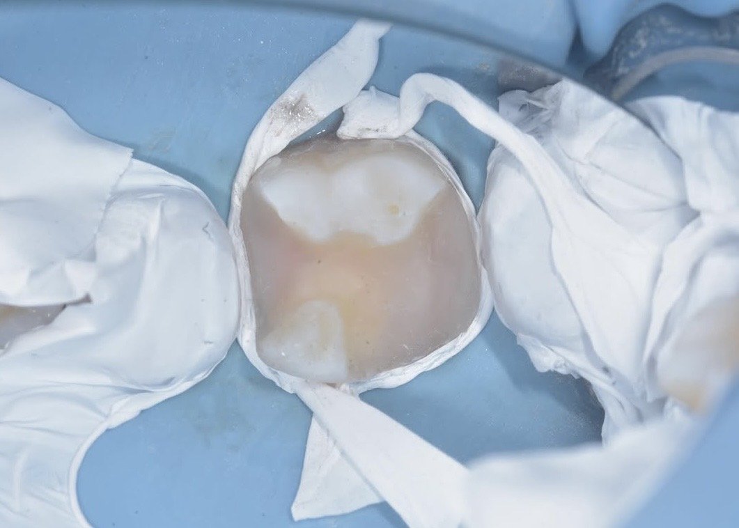 Biobase case example by Dr Davey Alleman 9.jpg