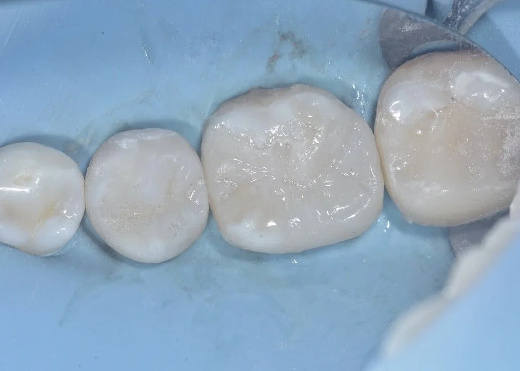 Biobase case example by Dr Davey Alleman 10.jpg