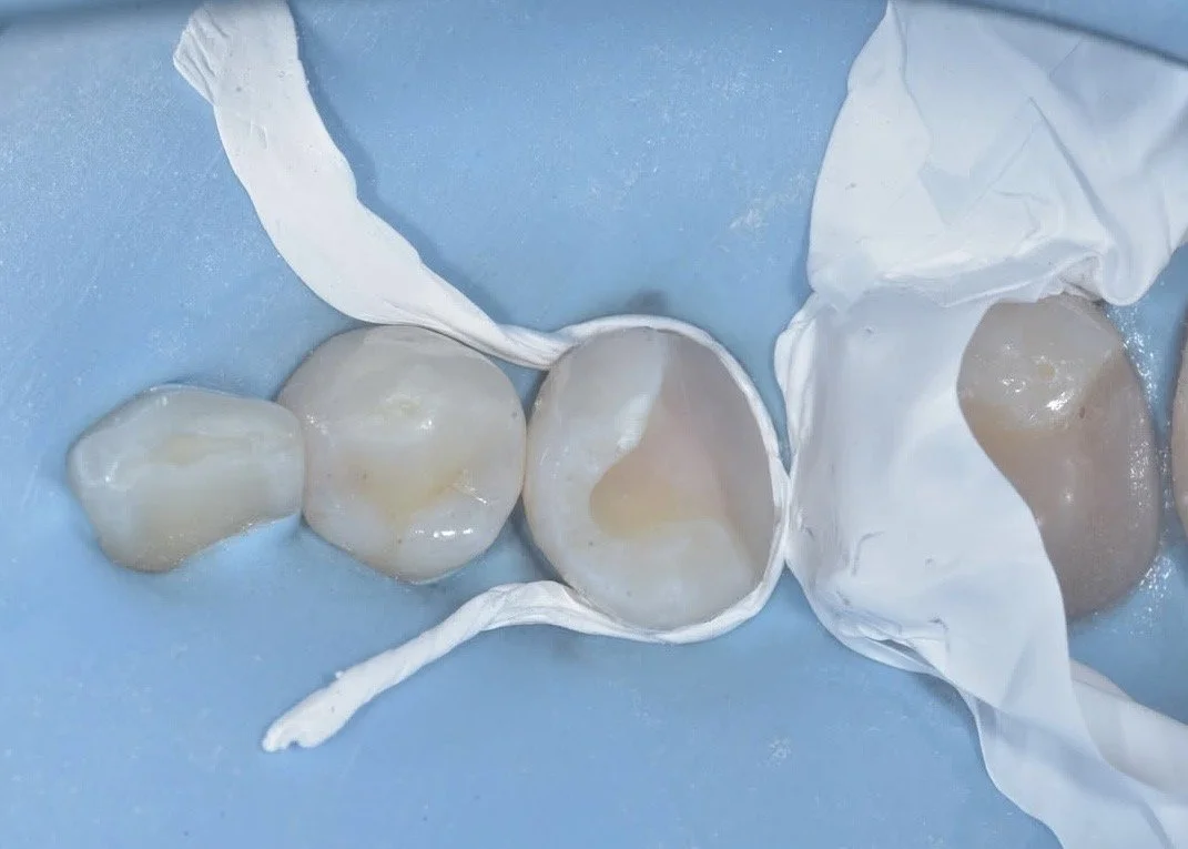 Biobase case example by Dr Davey Alleman 8.jpg