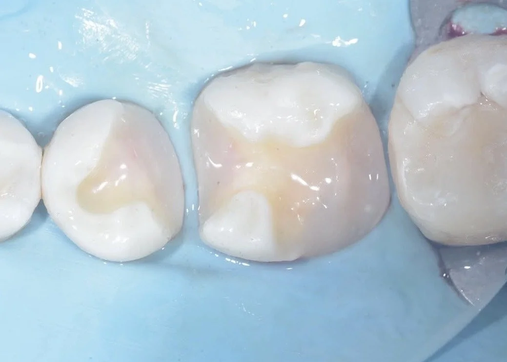 Biobase case example by Dr Davey Alleman 7.jpg