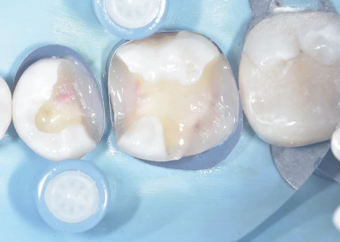 Biobase case example by Dr Davey Alleman 6.jpg