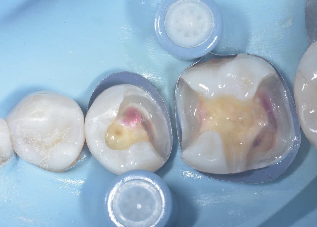 Biobase case example by Dr Davey Alleman 5.jpg