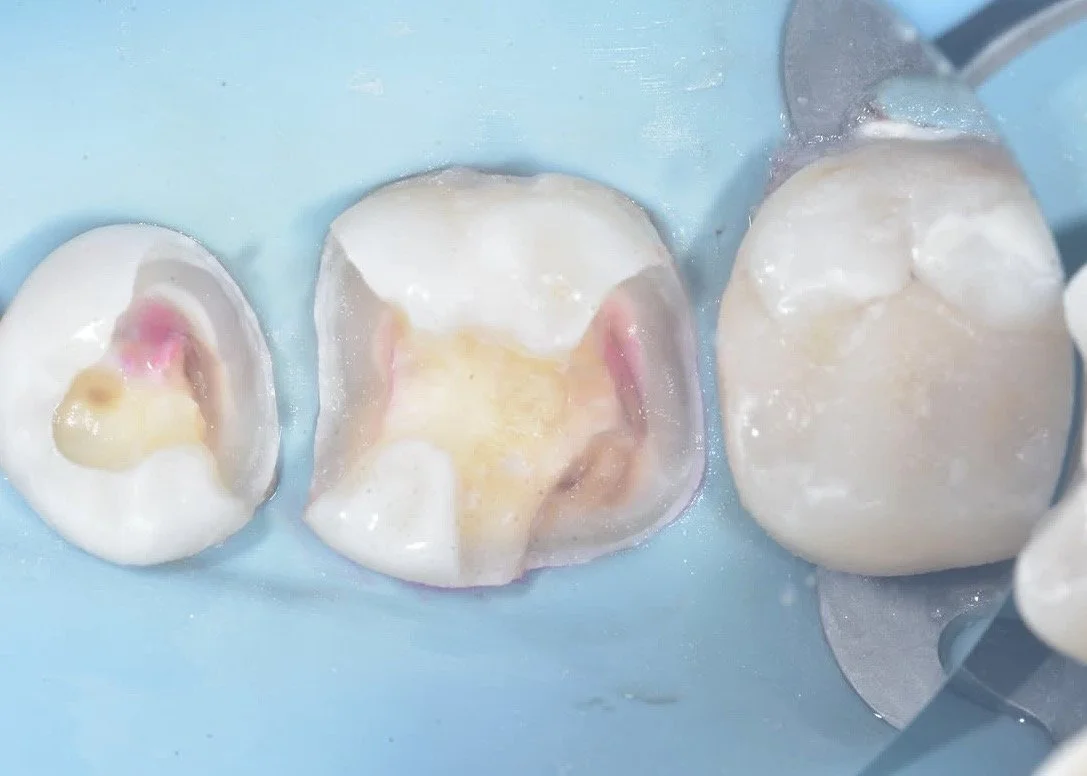 Biobase case example by Dr Davey Alleman 4.jpg