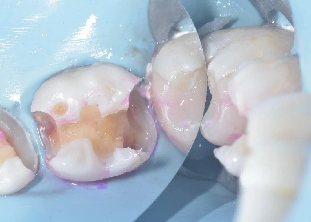 Biobase case example by Dr Davey Alleman 3.jpg