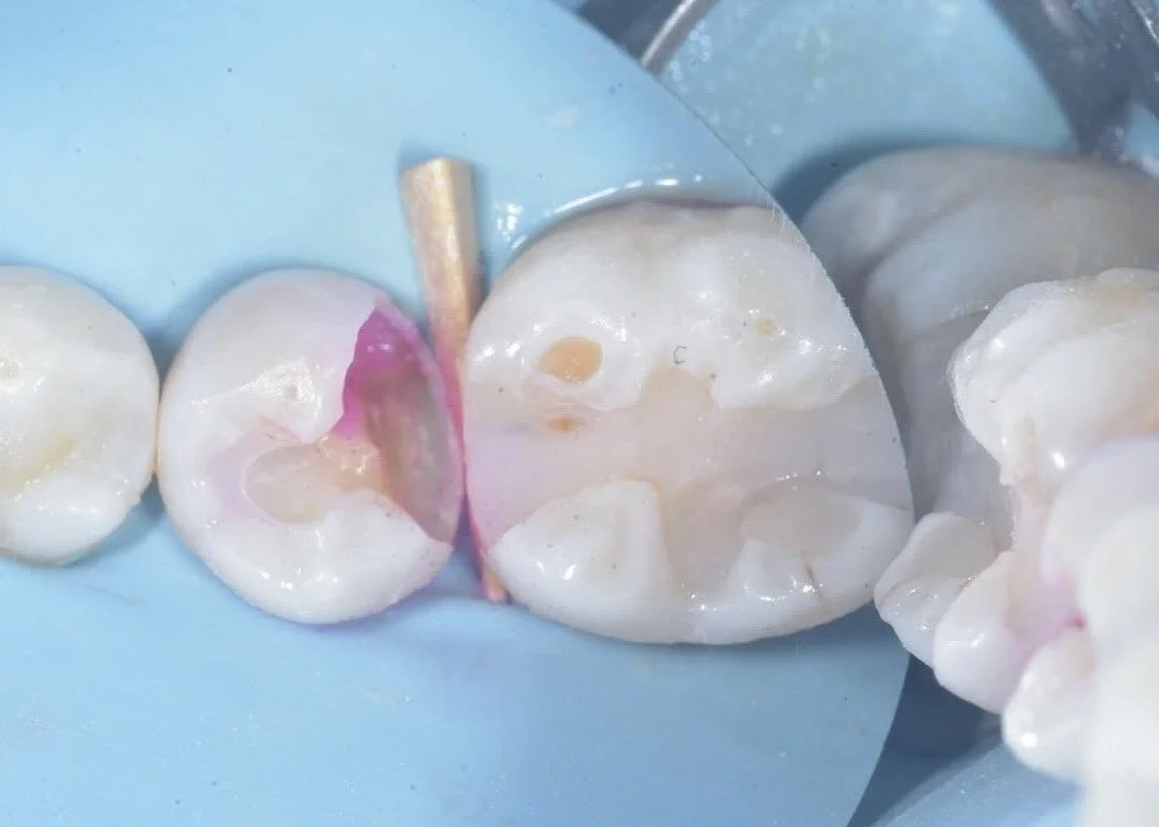 Biobase case example by Dr Davey Alleman 2.jpg