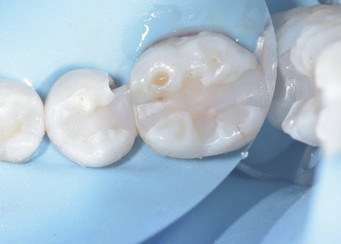 Biobase case example by Dr Davey Alleman 1.jpg