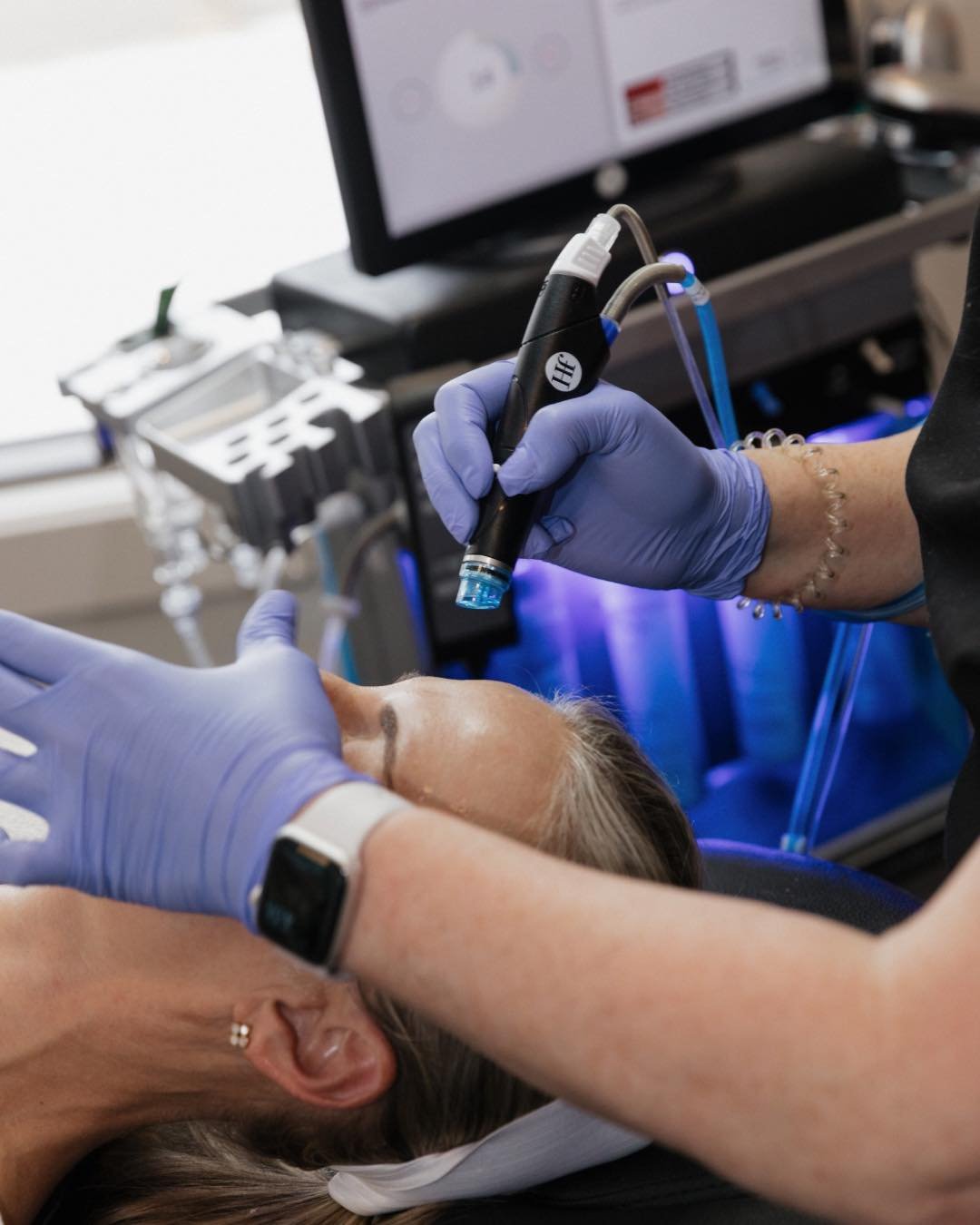 FREE HYDRAFACIAL ALERT 🚨 Get your 4th Hydrafacial for FREE when you purchase a package of 3 treatments. PLUS, a dermaplaning with each treatment 😉

💧 What it is: A multi-step facial that cleanses, exfoliates, extracts, and hydrates.

⚡ Process: Us