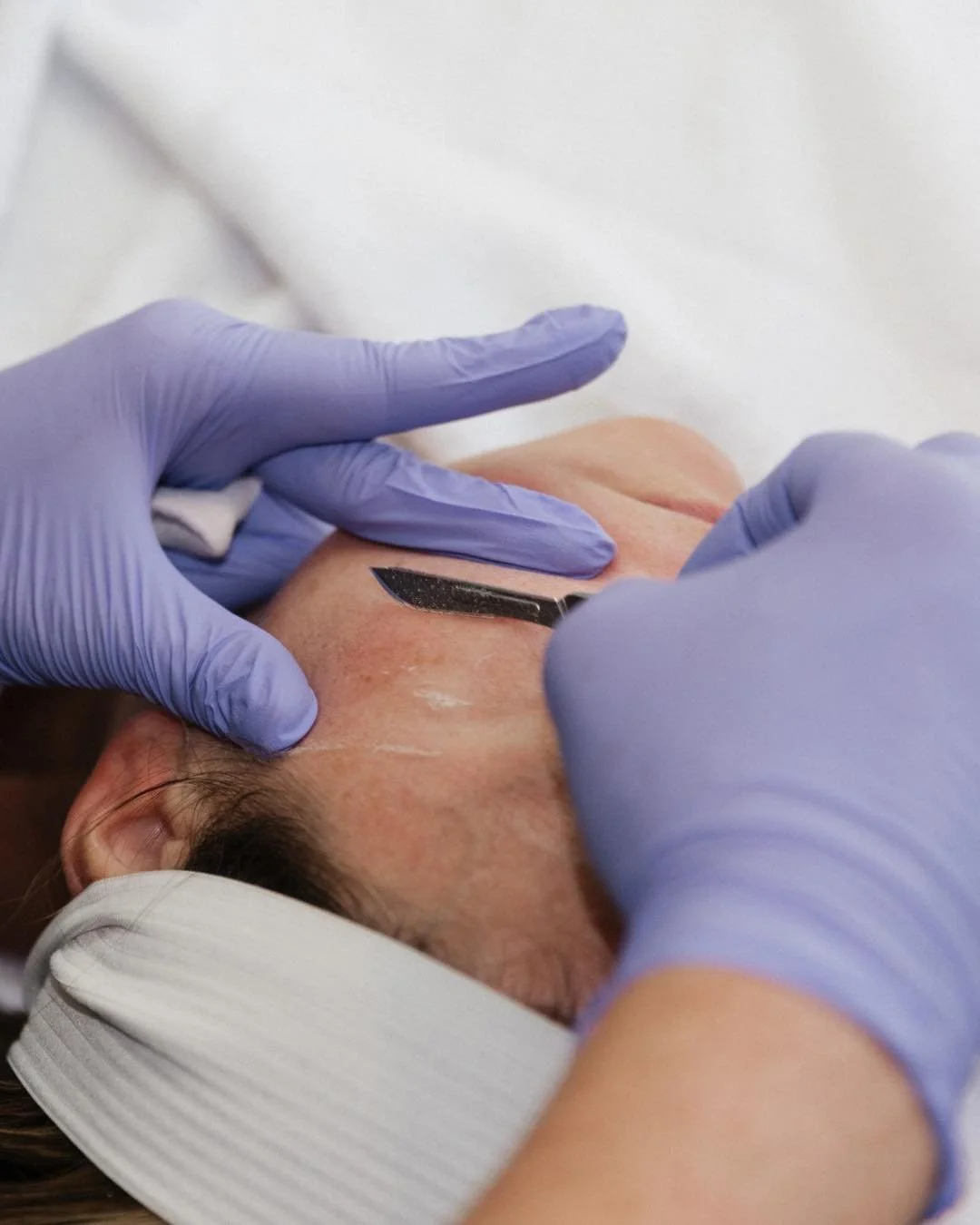 Glowing skin starts at Remedy+ ✨ Dermaplane 🤝HydraFacial = the perfect duo to help you treat dry, winter skin. Cleanse, exfoliate, extract, and hydrate while infusing serums all in one appointment for an instant glow &amp; no downtime. Call 616-214-