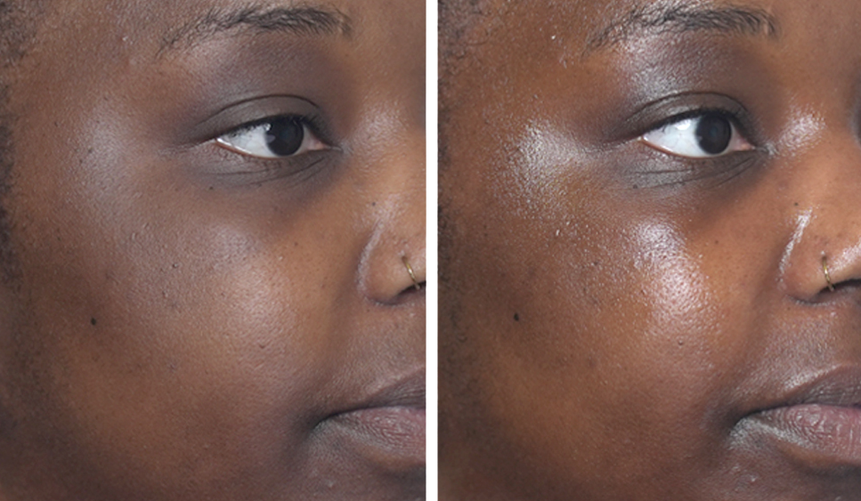  You’ll see increased visible brightness and hydration with improved appearance of skin suppleness and glow. 