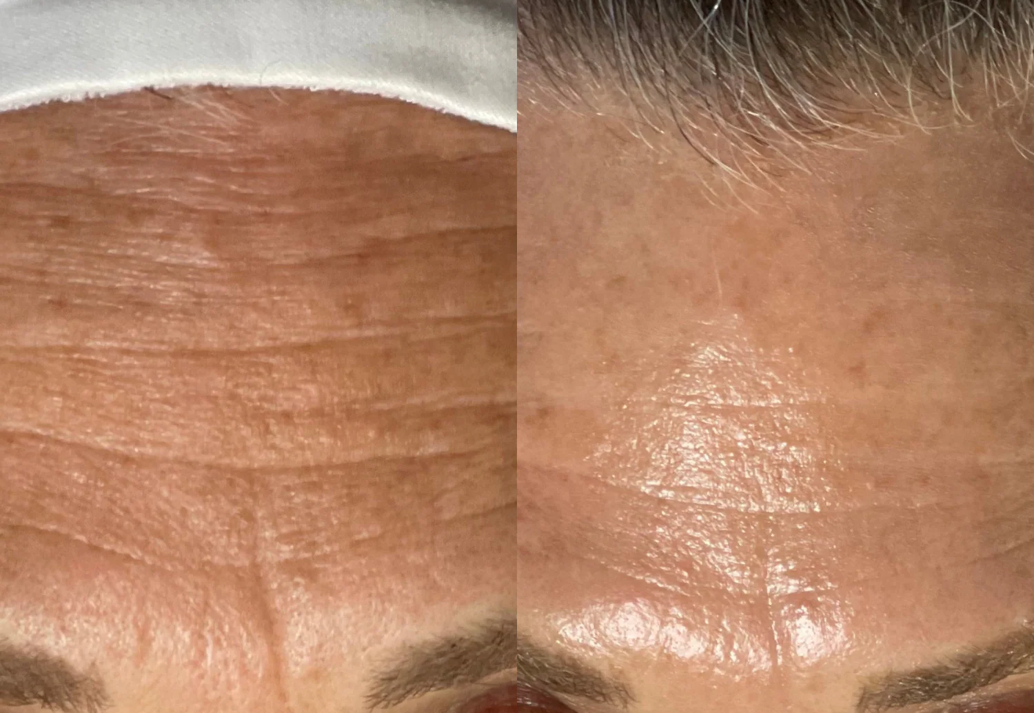  Achieve improved visible signs of aging skin, including fullness, radiance and smoothness. 