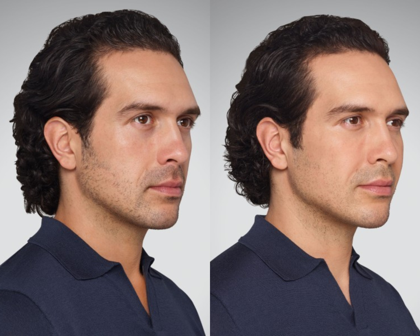 REMEDY+ B4 & AFTER.png