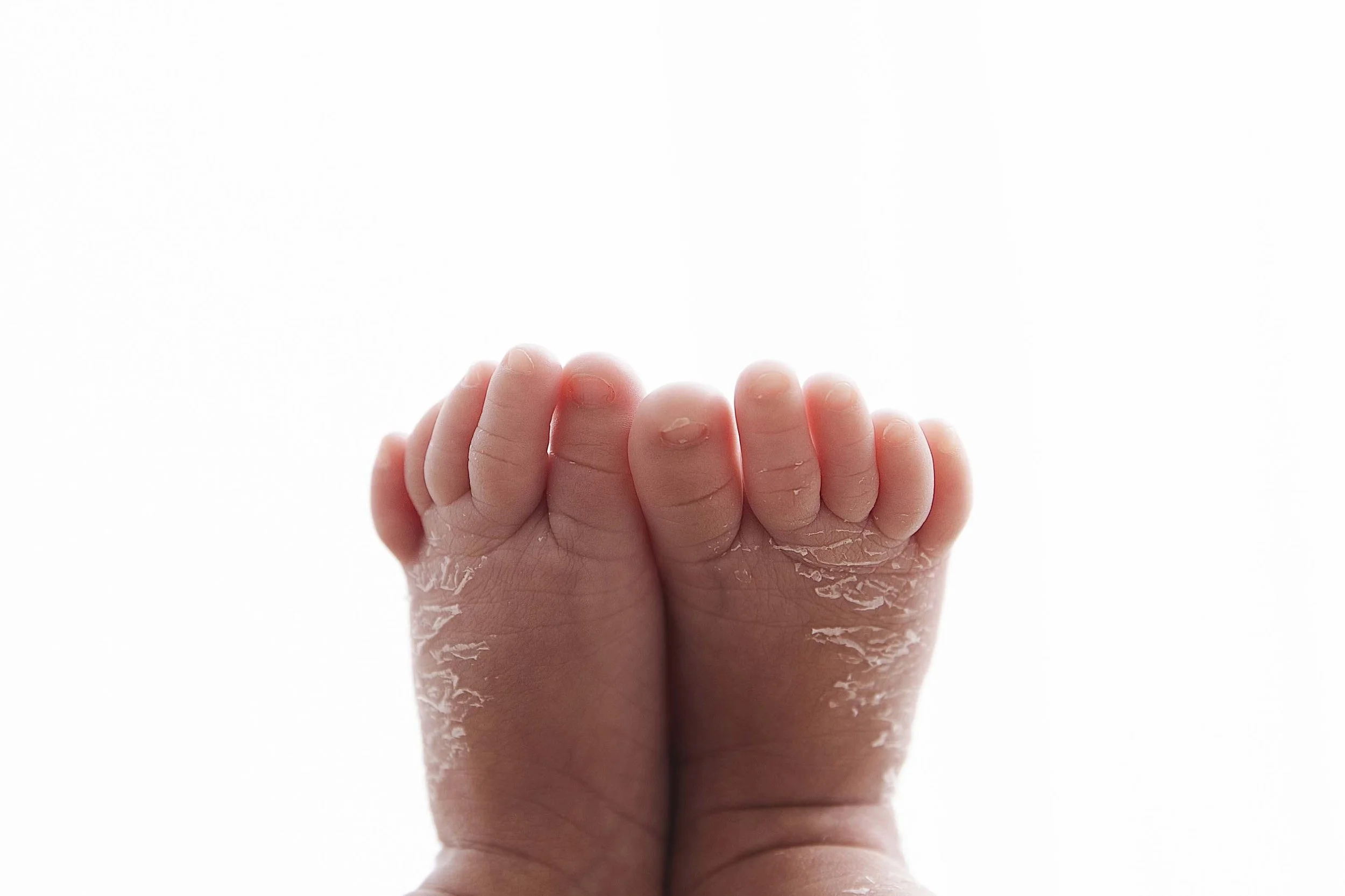 close-up photo of toes