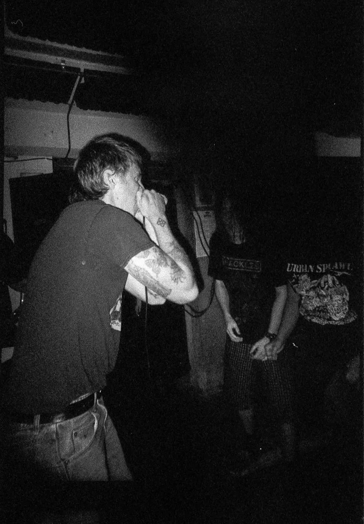  Cerebral Erosion 