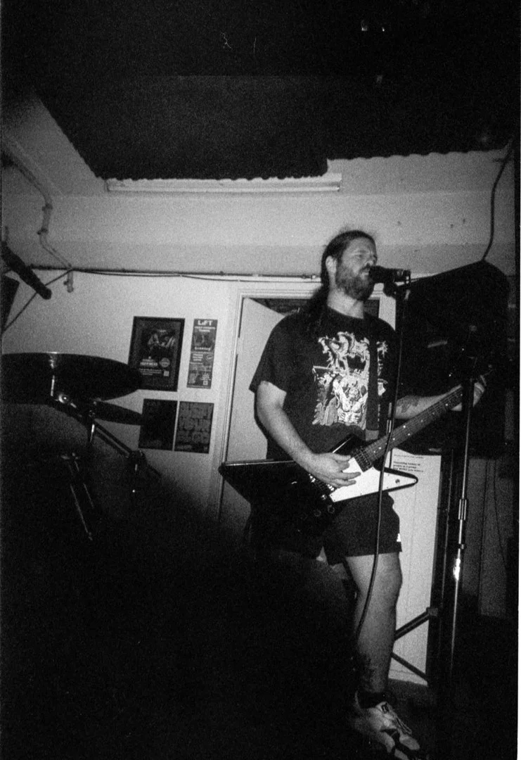  Cerebral Erosion 