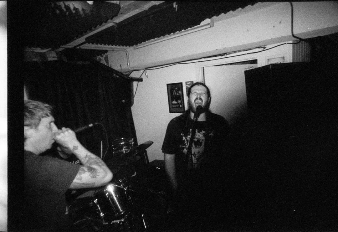  Cerebral Erosion 
