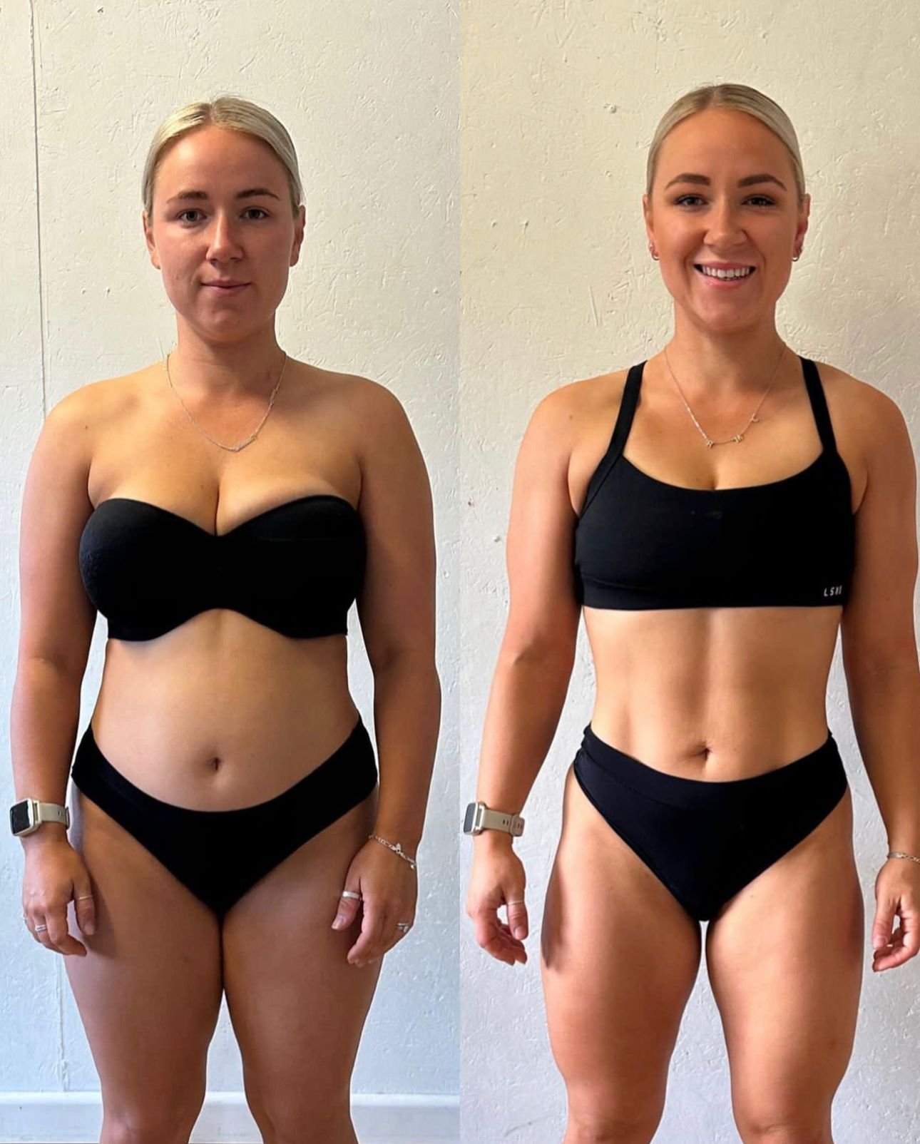 Riley D before and after.jpg