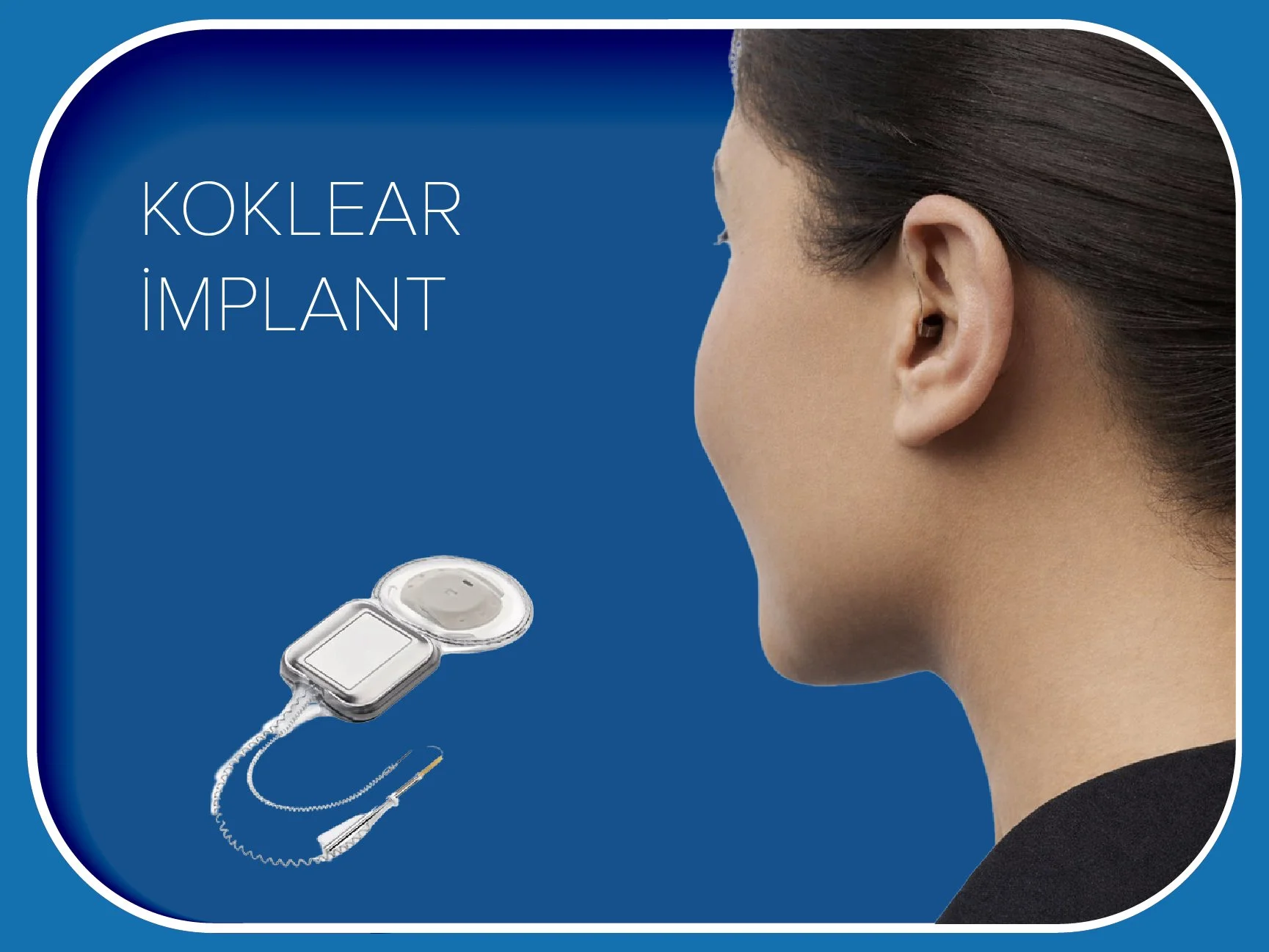 koklear implant