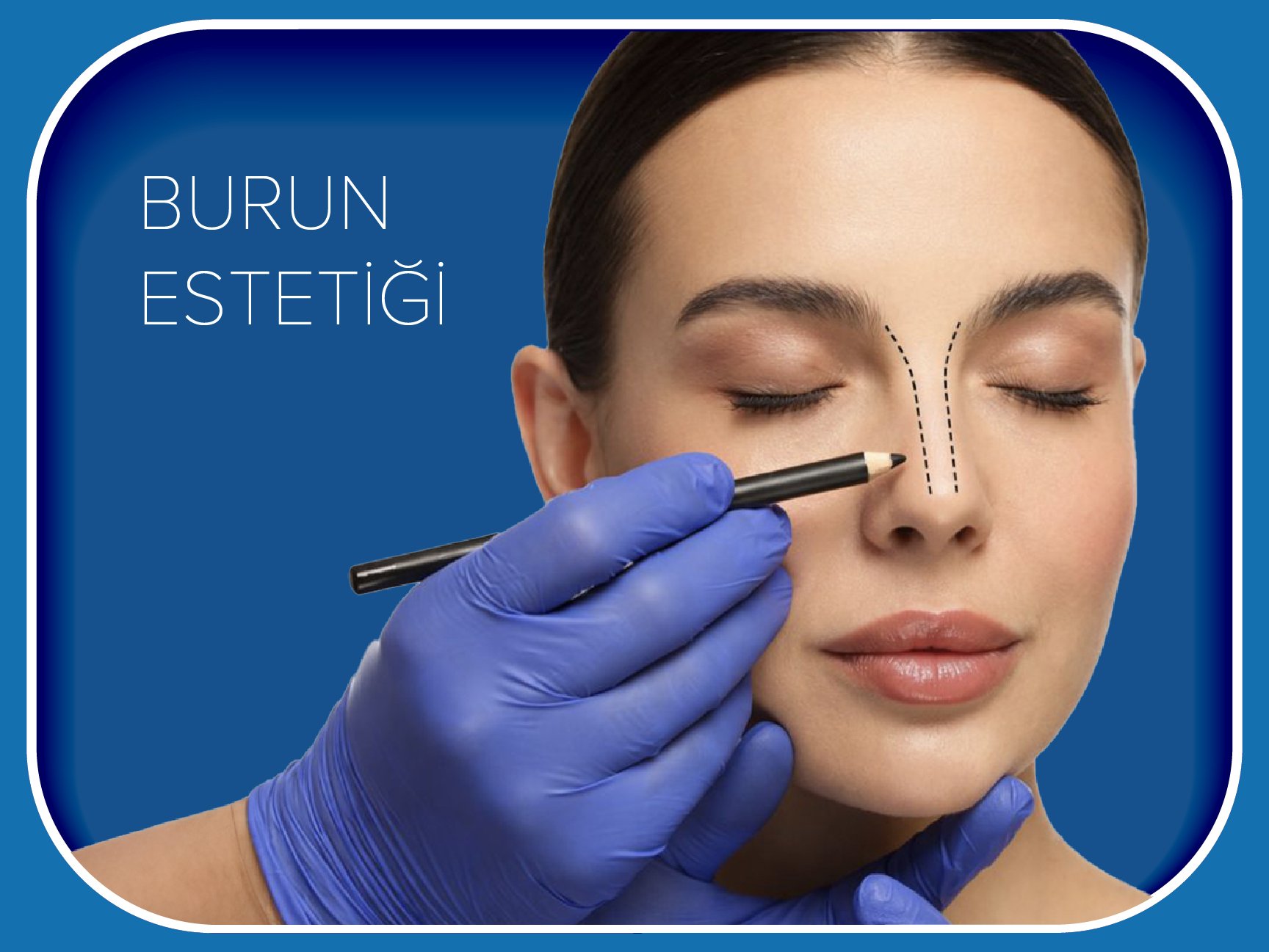 burun estetiği