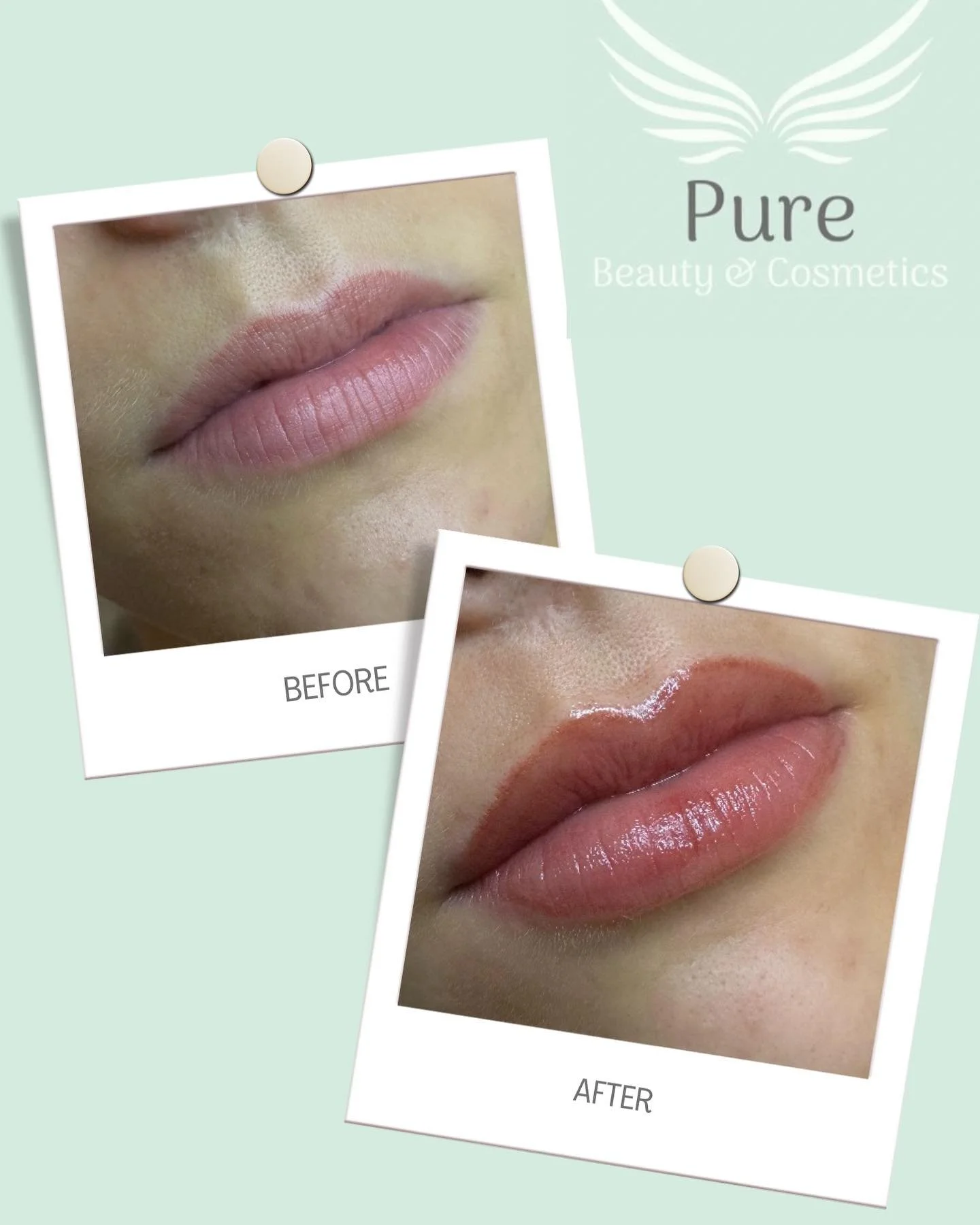 Lips before and after.jpg