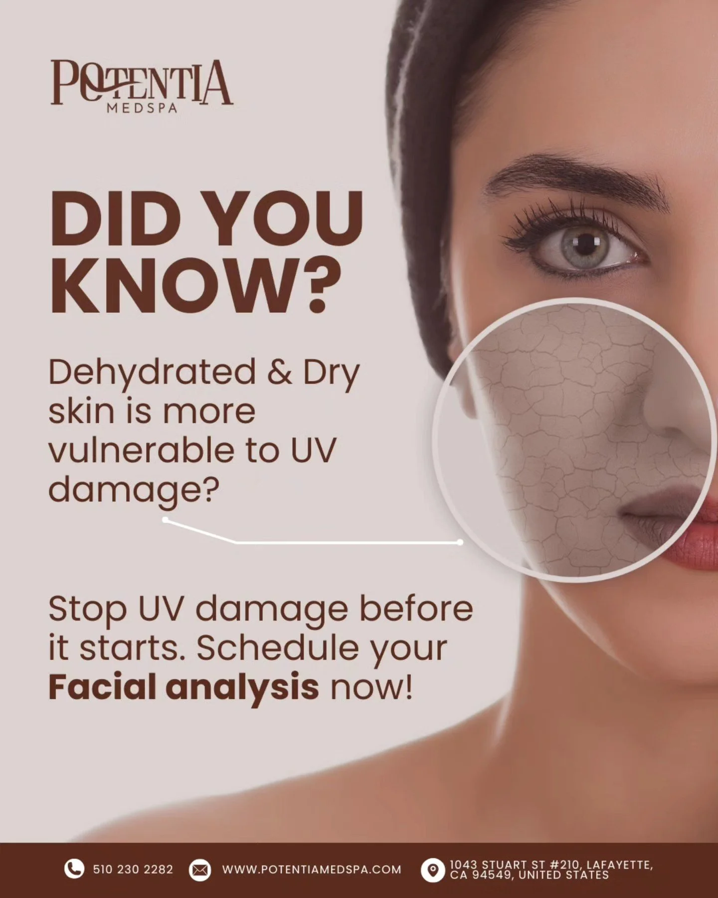✨ Dry skin and UV damage go hand in hand&mdash;but it doesn&rsquo;t have to be that way! ✨

Dry skin makes your skin barrier weaker, leaving it more prone to:
🌞 Increased UV damage
🌞 Faster aging
🌞 Sunspots and uneven texture

A facial analysis is