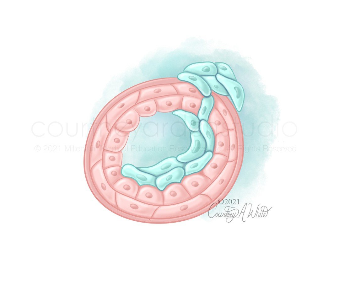 These illustrations were created for a two-page patient education tear pad on metastatic triple-negative breast cancer (mTNBC). The term triple-negative refers to three receptors commonly found in breast cancer: the estrogen receptor (ER), progestero