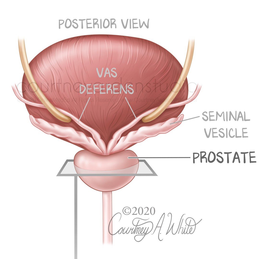 This illustration was made for medical education purposes regarding the prostate gland. The prostate gland is located below the bladder and in front of the rectum. It encircles the urethra, which is why an enlarged prostate due to conditions such as 