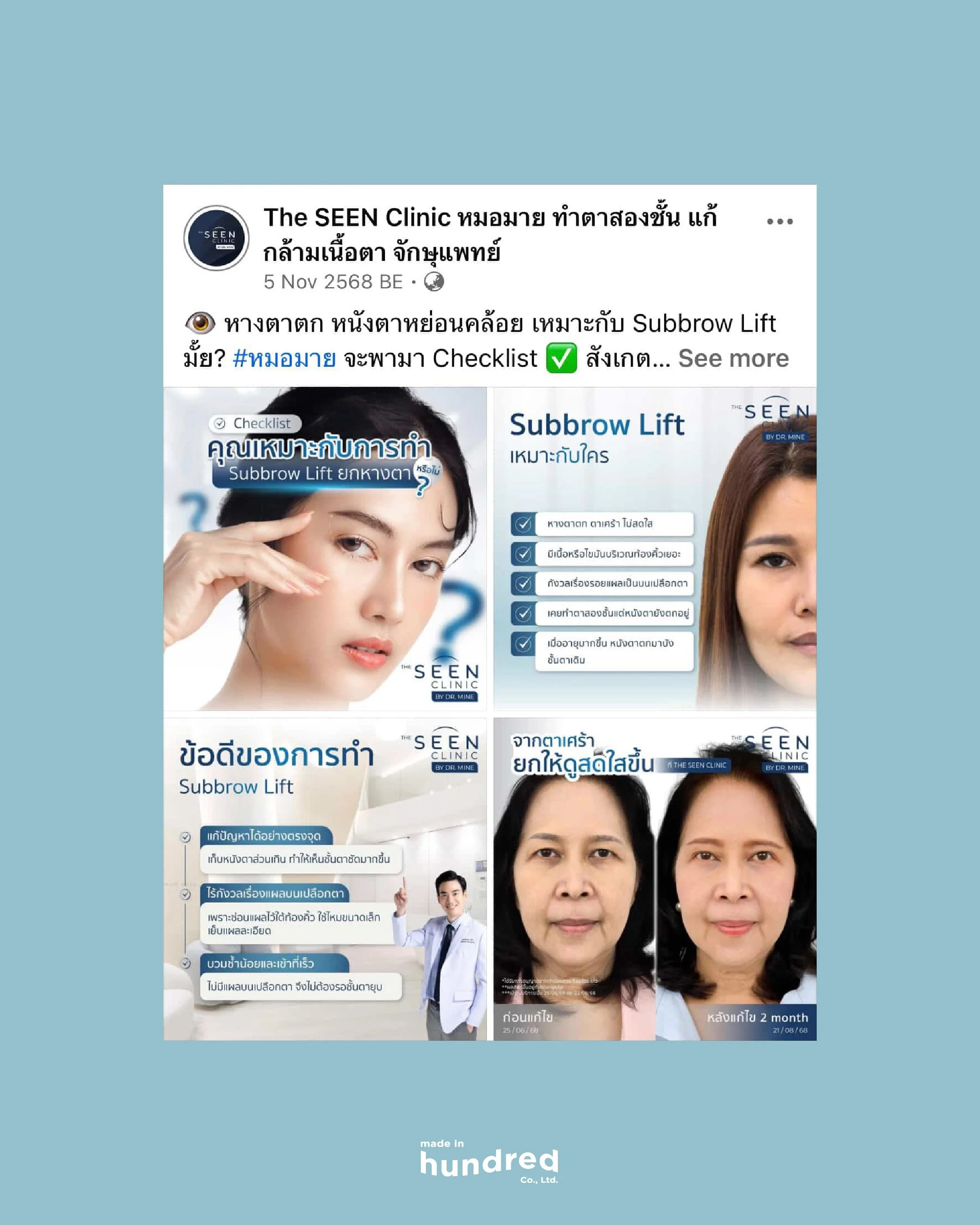 MH-IG-The Seen Clinic_5.jpg