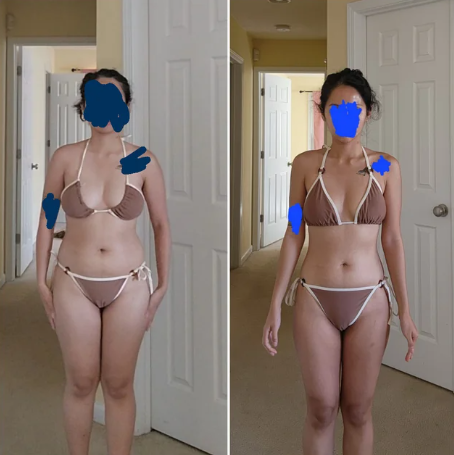 GLP-1 Weight Loss Shots in 32081: Step-by-Step Guide to Starting Safely