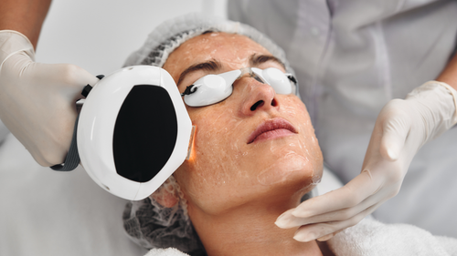 IPL Treatment Ponte Vedra