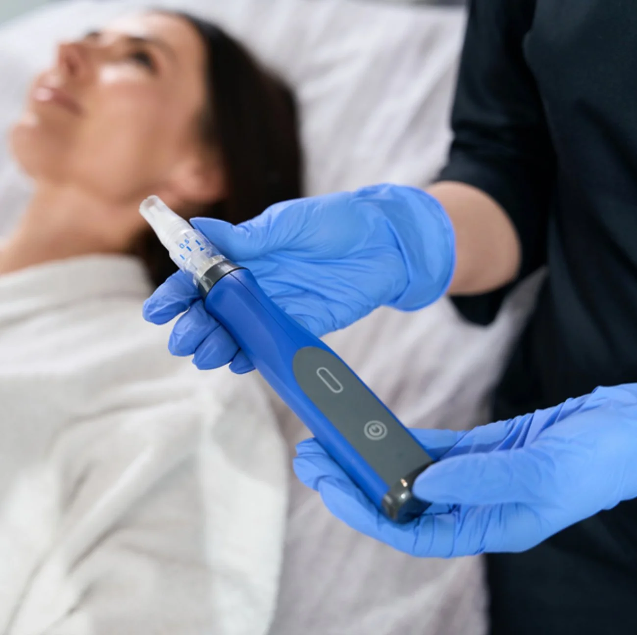 Microneedling near me Ponte Vedra - session