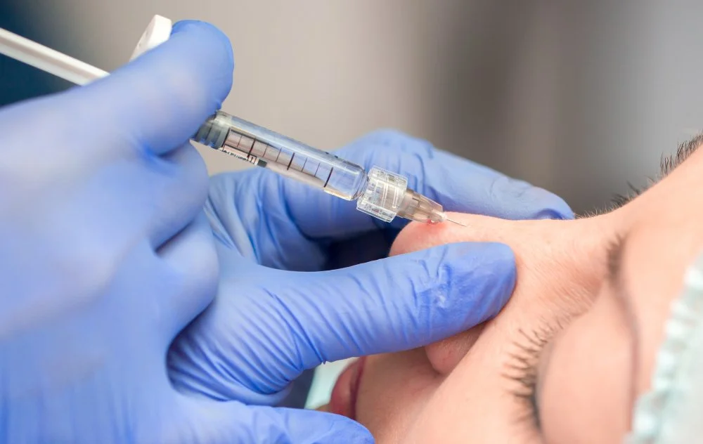 Liquid nose job before and after profile in Ponte Vedra, FL