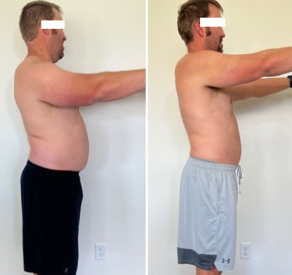 Semaglutide Weight Loss in Ponte Vedra FL: Complete Guide