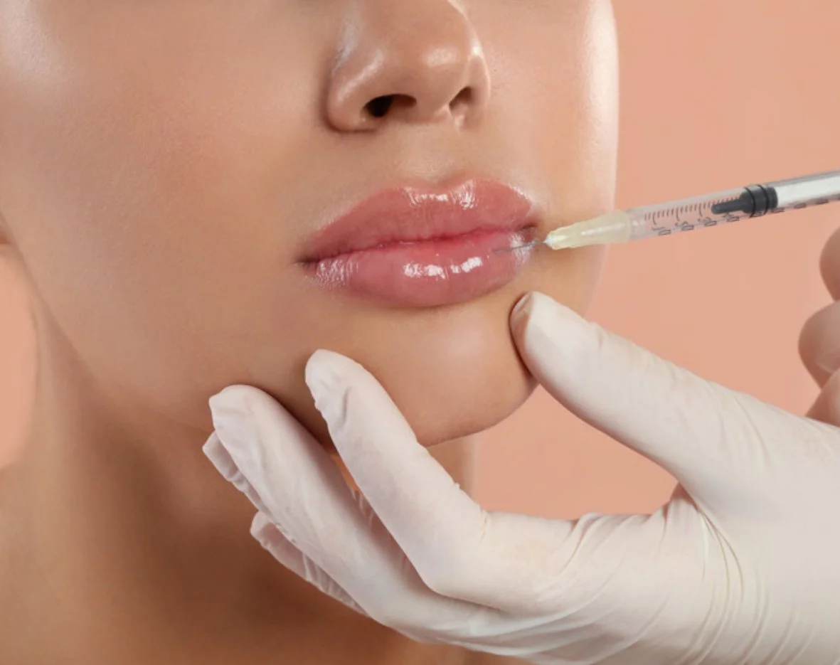 Lip filler with Revanesse Versa+ Lips in Jacksonville FL
