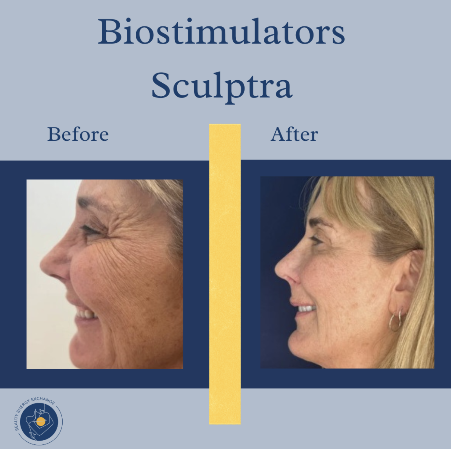 sculptra Ocean Beach