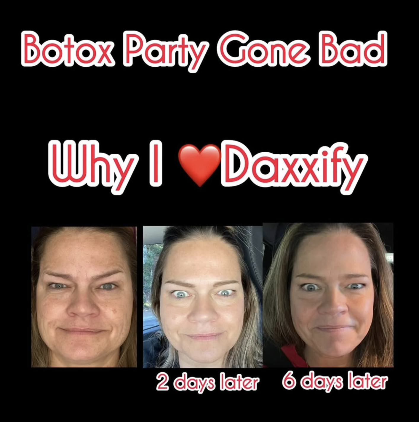 Why Cheap Botox in San Diego Can Cost You More Long-Term