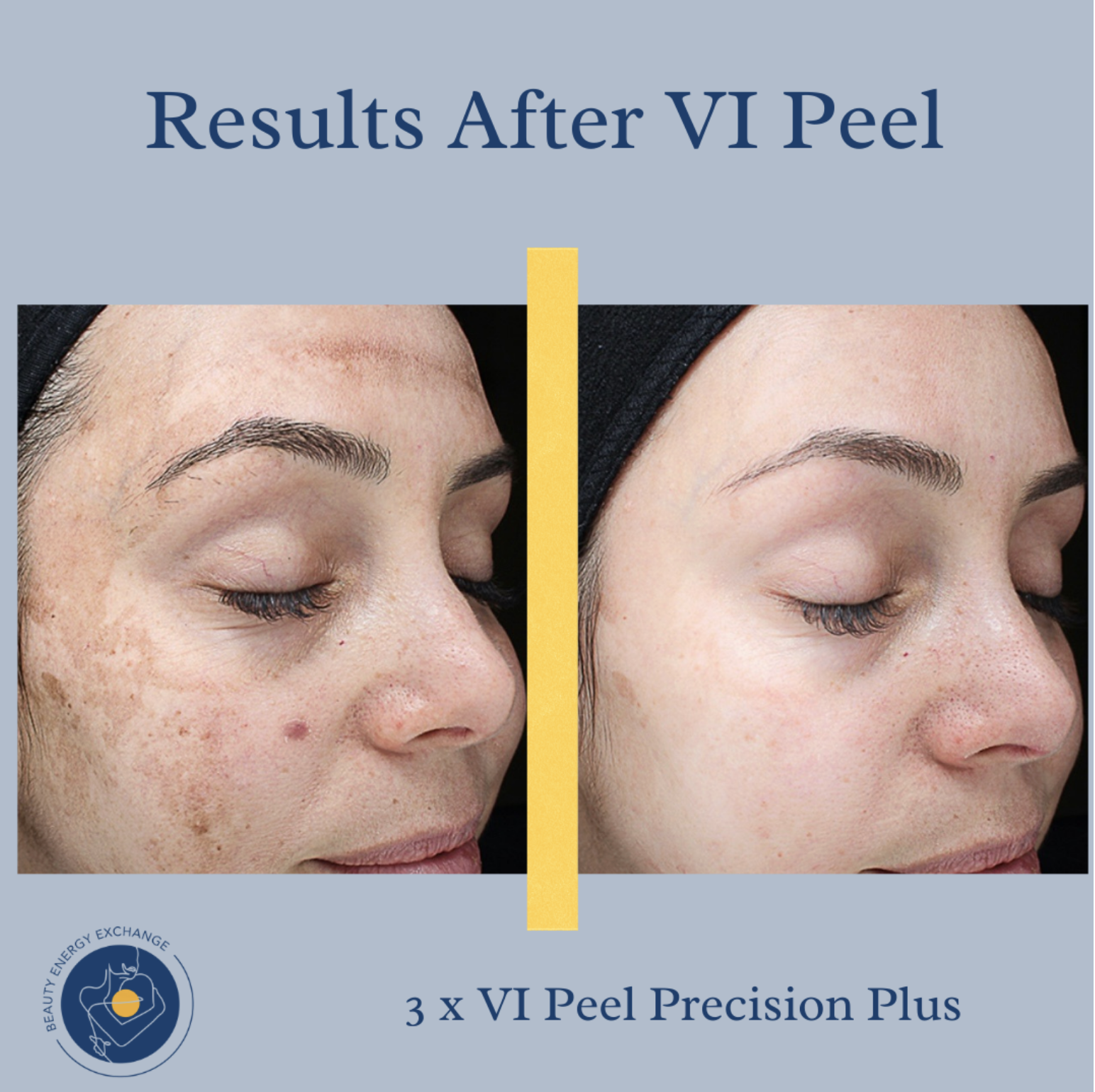 medical-grade skincare Point Loma