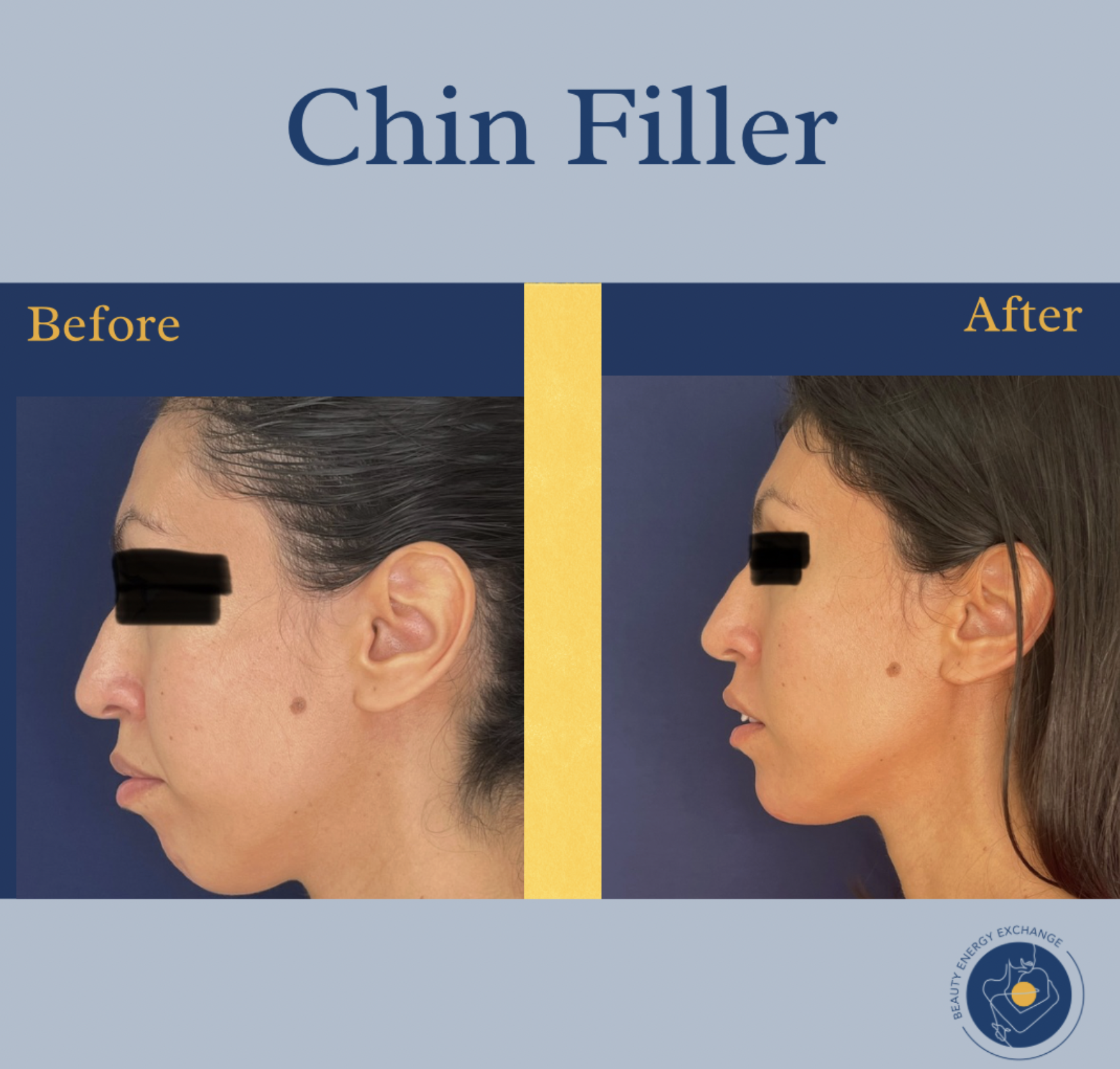 Pay Attention to Before-and-After Results