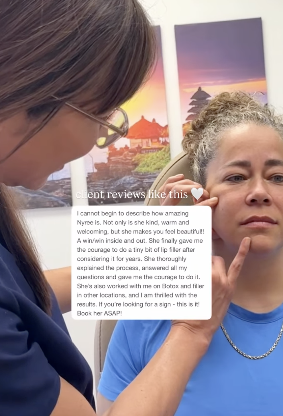 lip filler review in San Diego