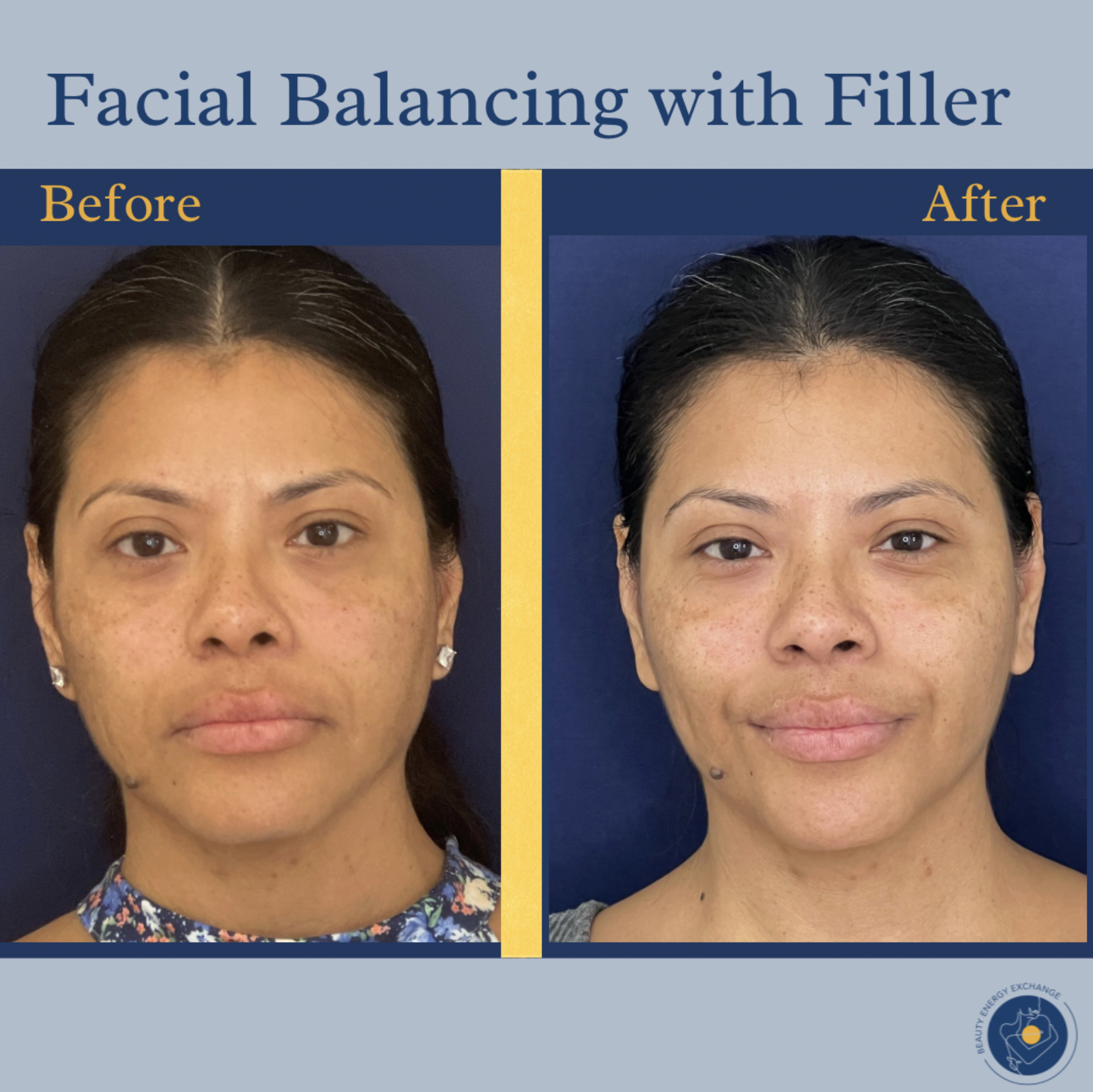 Natural Results Should Always Be the Goal