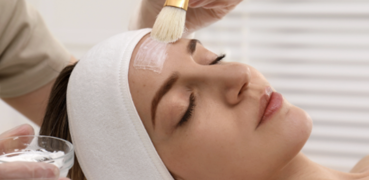what is a chemical peel? photo of a woman getting a chemical peel applied to her face