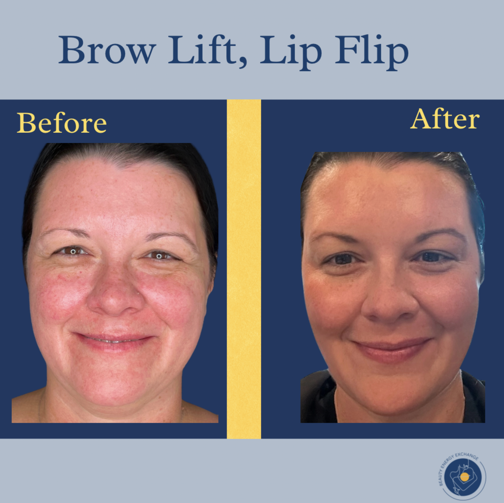 brow-lip-flip-san-diego-before-after.png