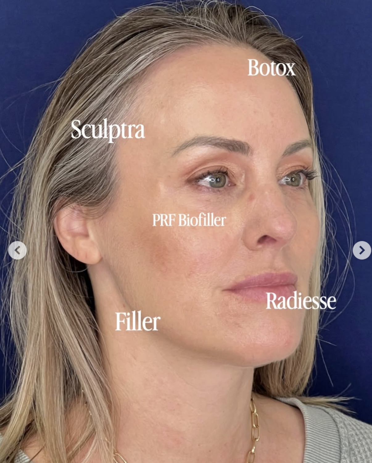 combined treatments