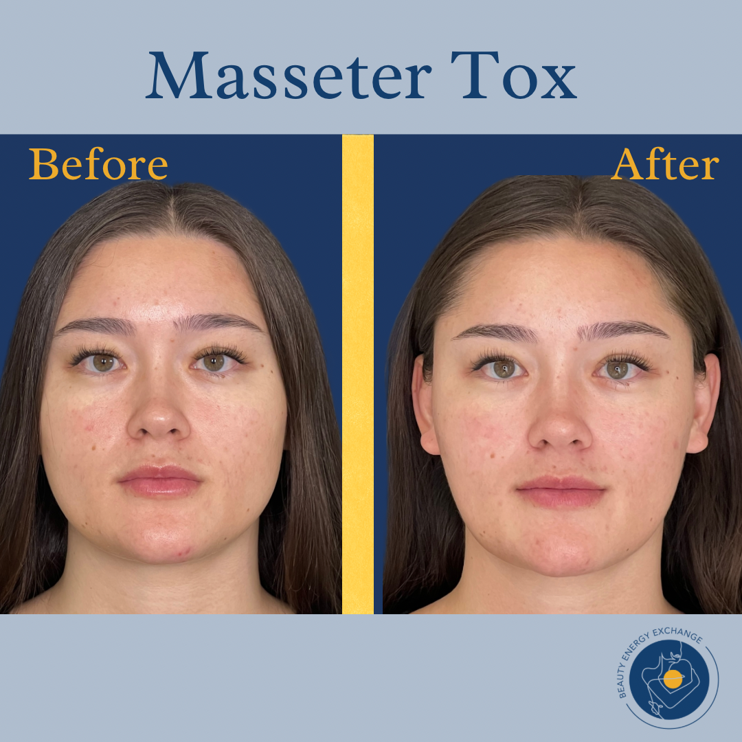 Copy of Copy of BEE BeforeAfters.png