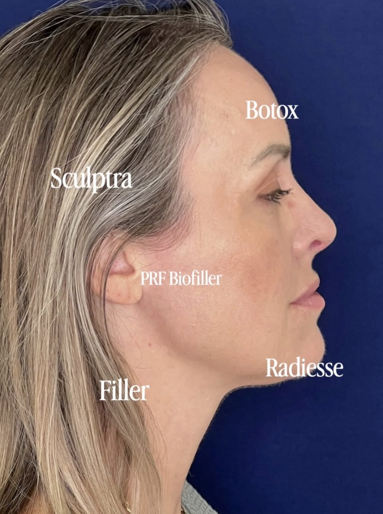 Med spa treatments
