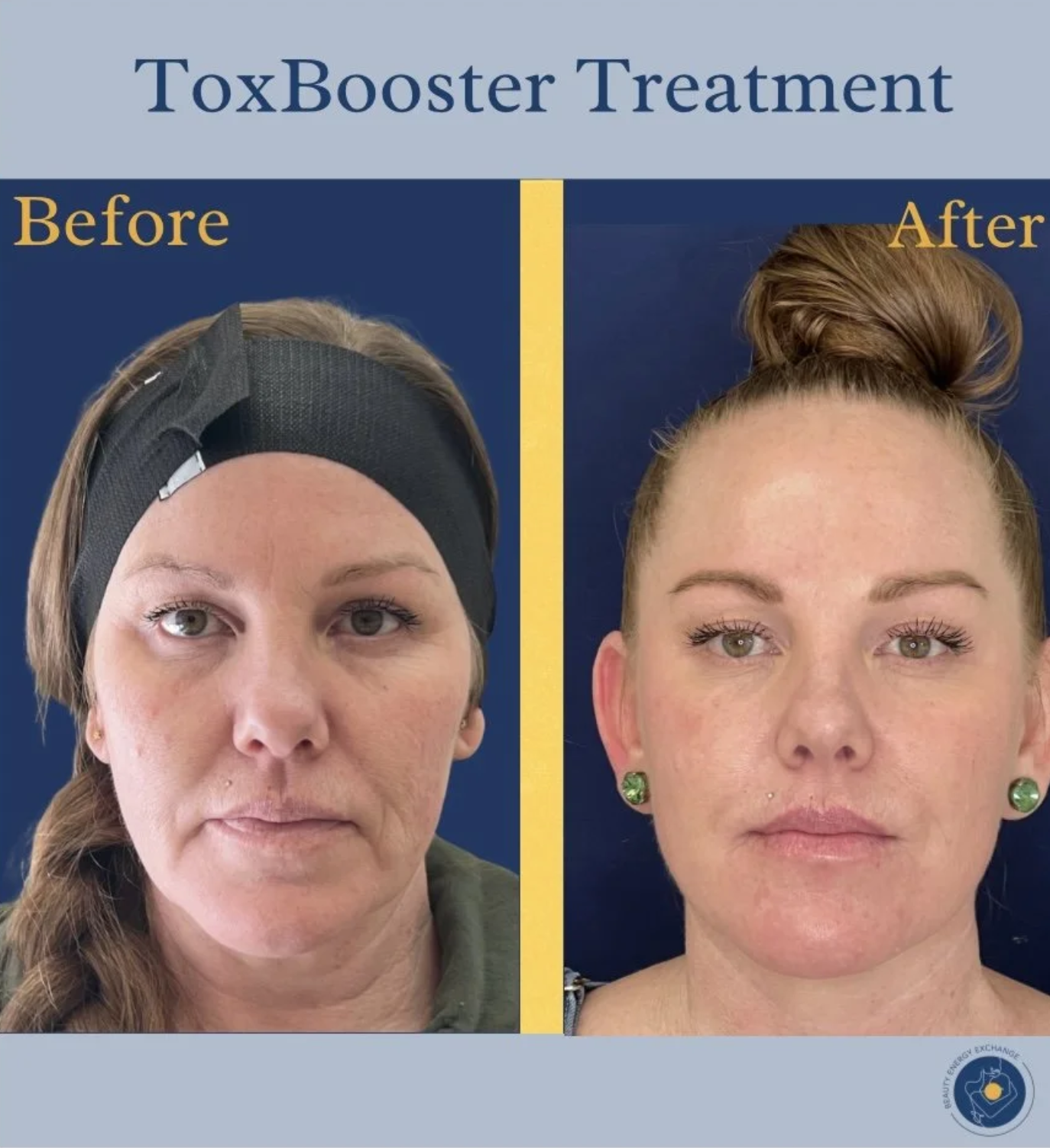 The Safety Record of Non-Surgical Cosmetic Treatments