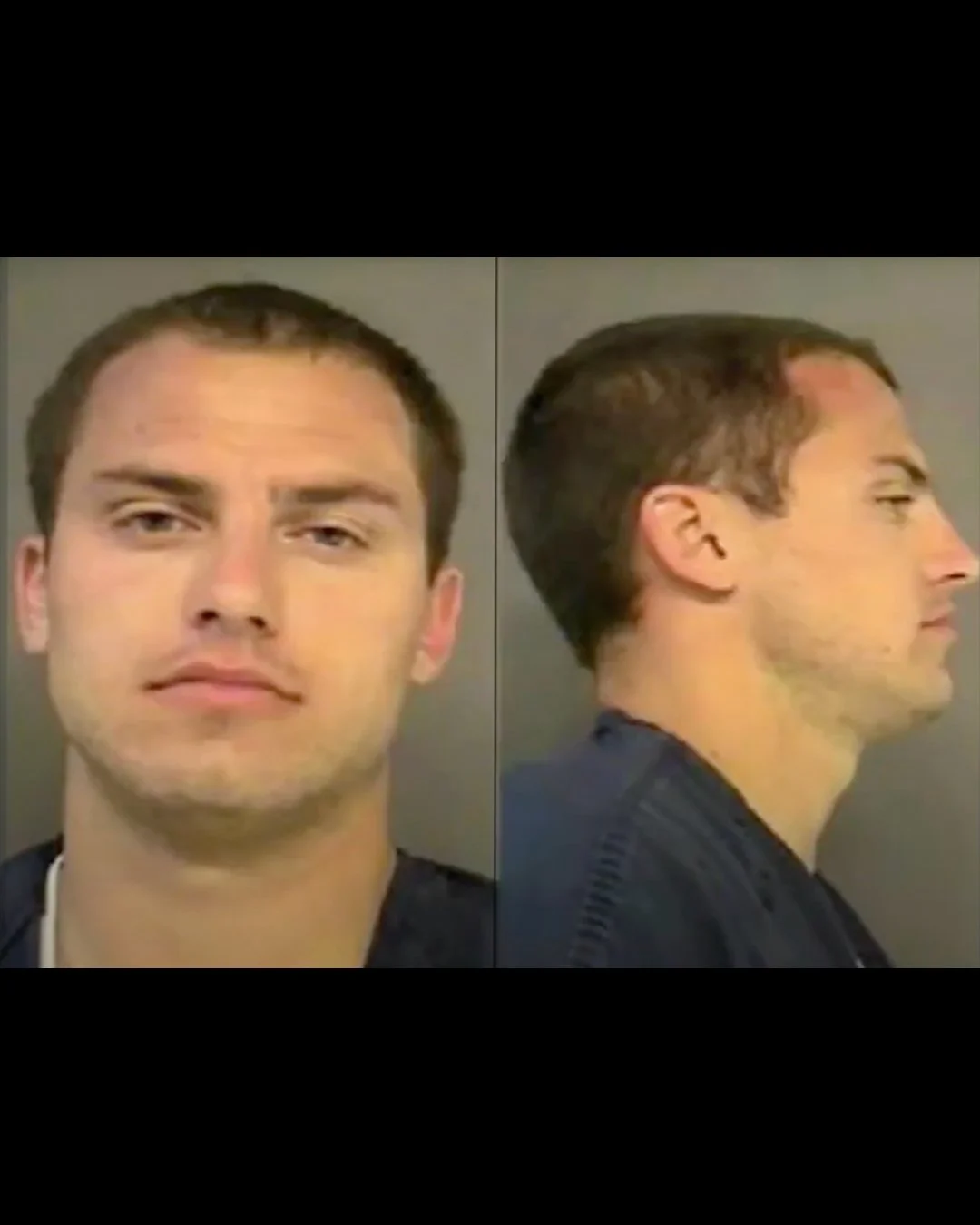 Anthony's mugshot