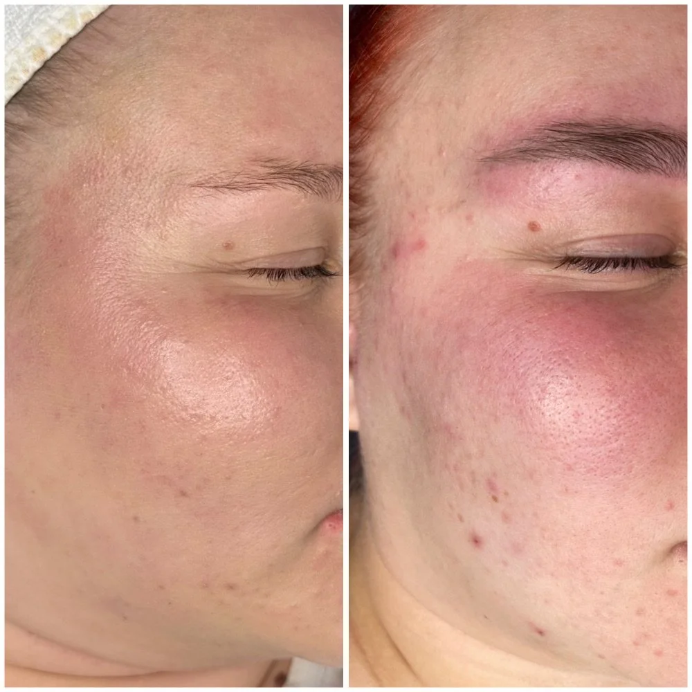 Simona's ennen/jälkeen kuva.