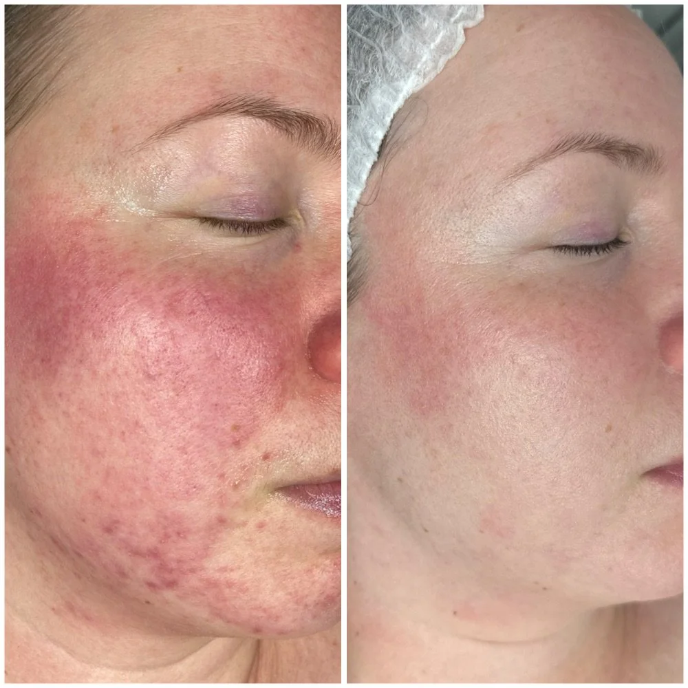 Simona's ennen/jälkeen kuva.