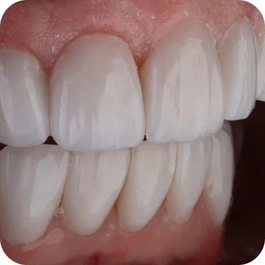 Teeth