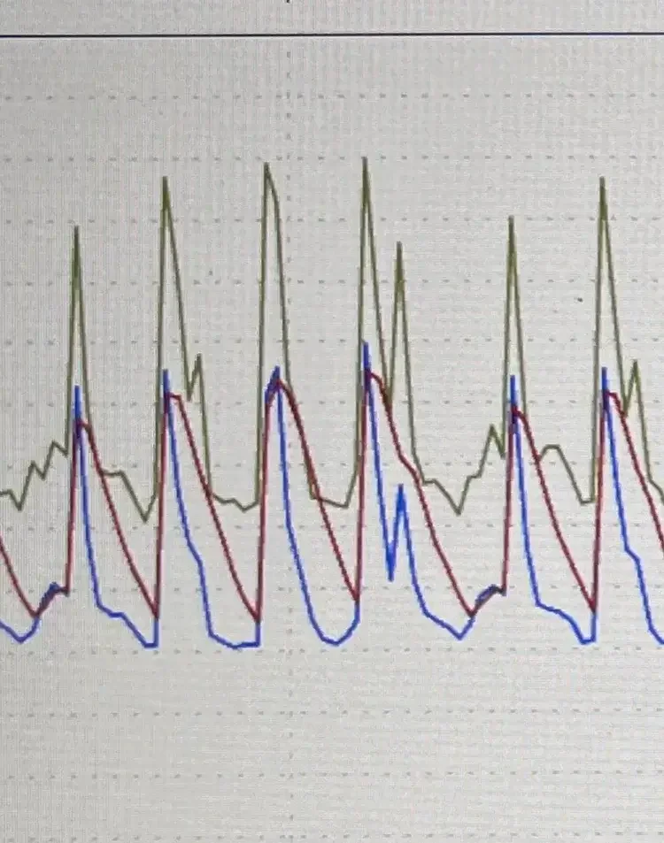 A line graph displaying multiple data series in different colors (black, yellow, red, blue) with peaks and valleys over time or sequential measurements.